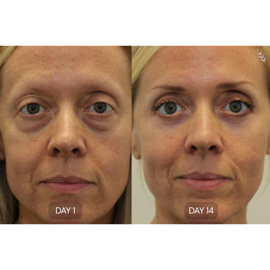 Peptide Collagen Hydrogel Eye Patches
