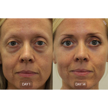 Peptide Collagen Hydrogel Eye Patches