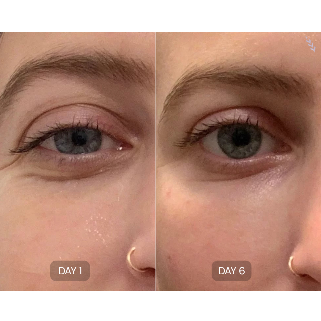 Peptide Collagen Hydrogel Eye Patches