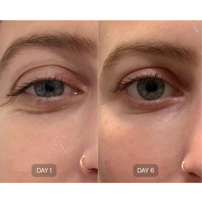 Peptide Collagen Hydrogel Eye Patches