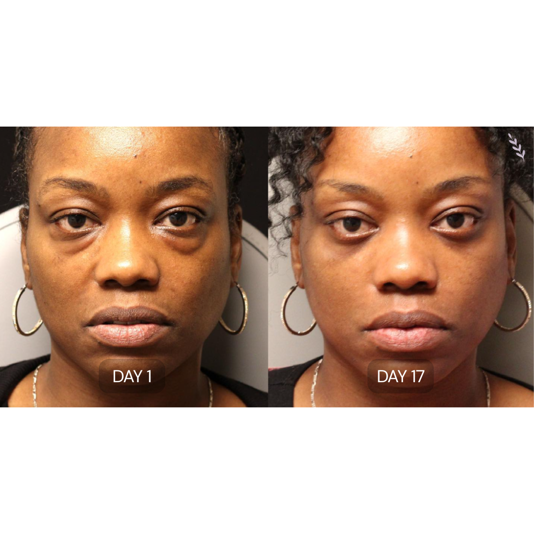 Peptide Collagen Hydrogel Eye Patches
