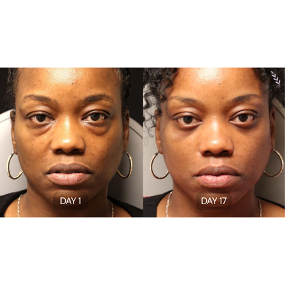 Peptide Collagen Hydrogel Eye Patches