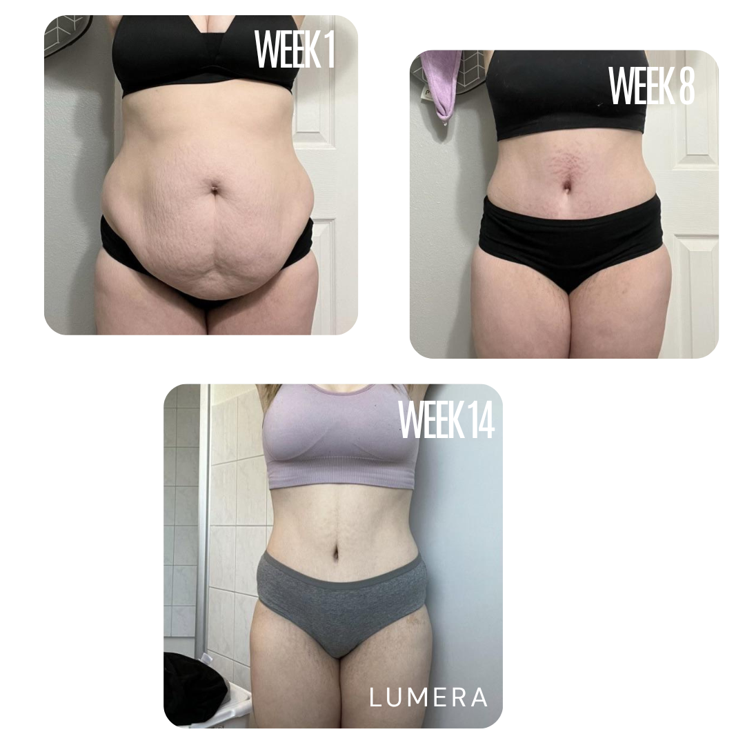 Lymphatic Drainage & Anti-Cellulite Massager