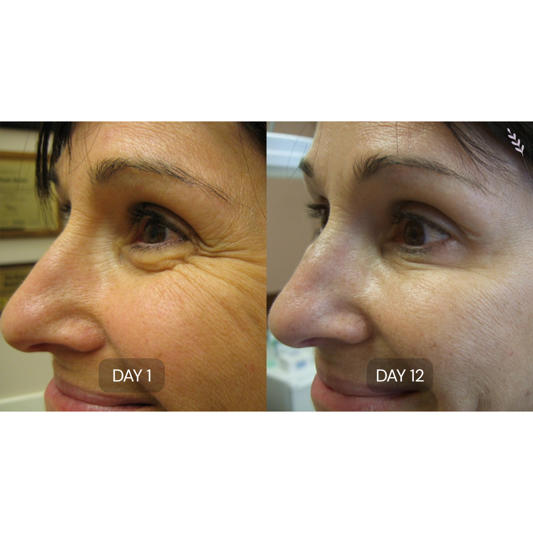 Peptide Collagen Hydrogel Eye Patches
