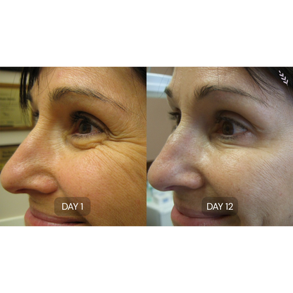 Peptide Collagen Hydrogel Eye Patches