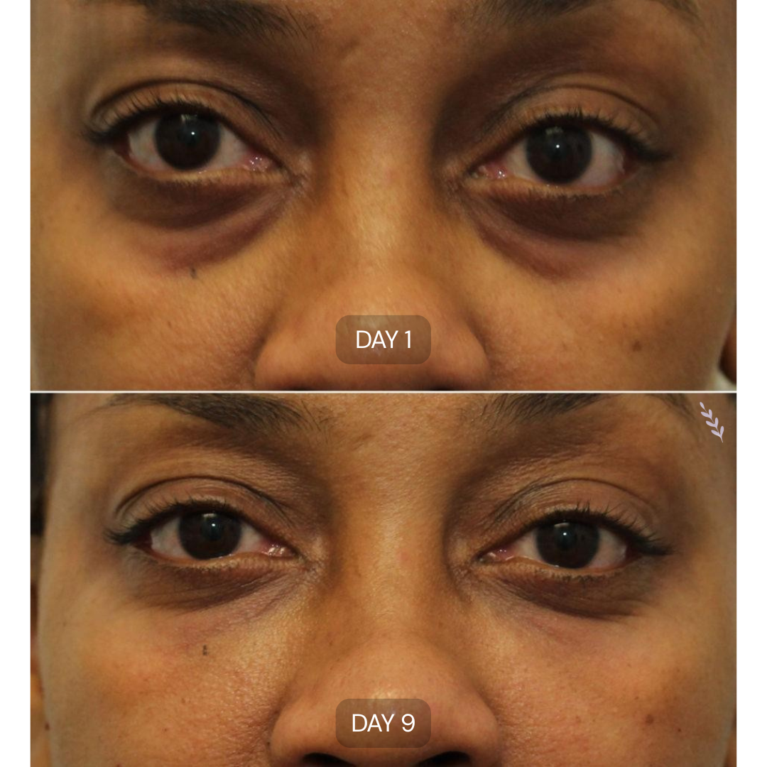 Peptide Collagen Hydrogel Eye Patches