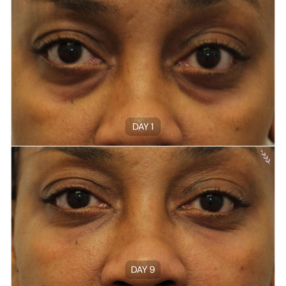 Peptide Collagen Hydrogel Eye Patches