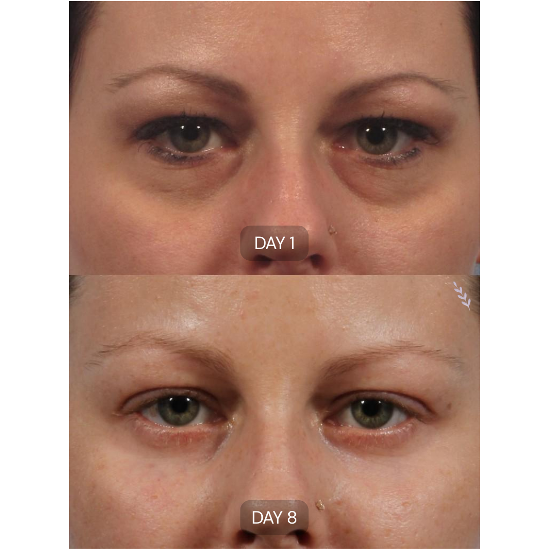 Peptide Collagen Hydrogel Eye Patches