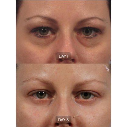 Peptide Collagen Hydrogel Eye Patches