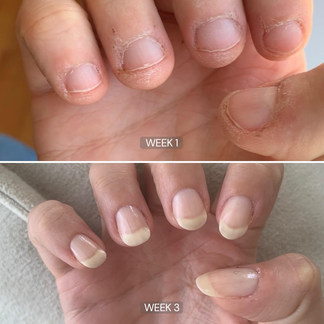 Nail Growth Oil