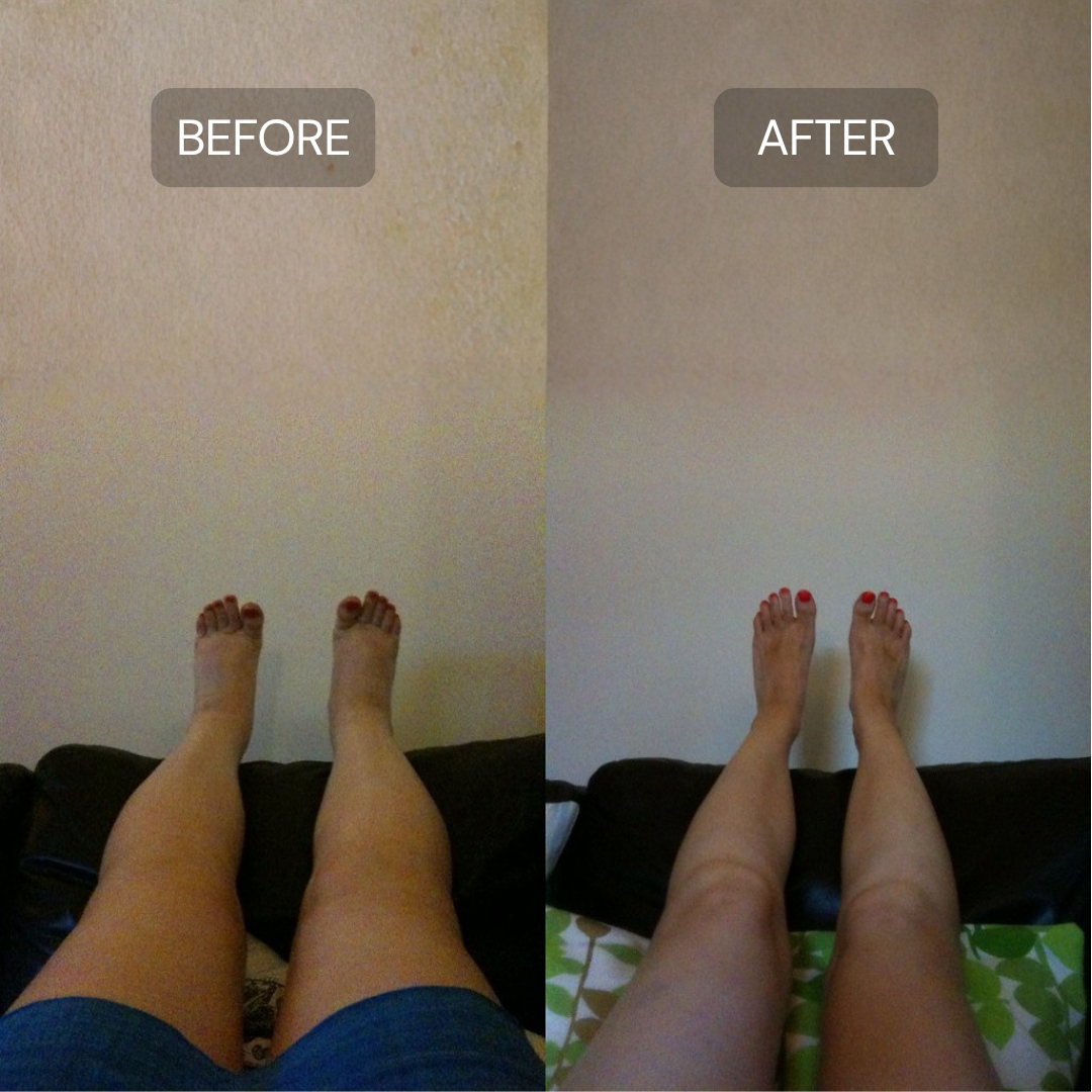 Lymphatic Support Herbal Drops