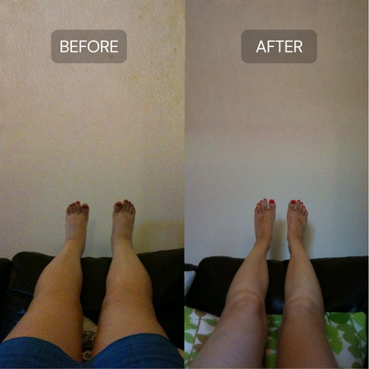 Lymphatic Support Herbal Drops