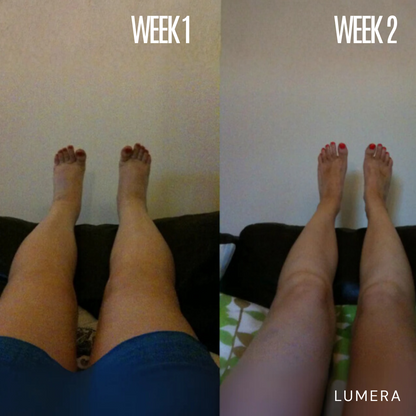 Lymphatic Drainage & Anti-Cellulite Massager