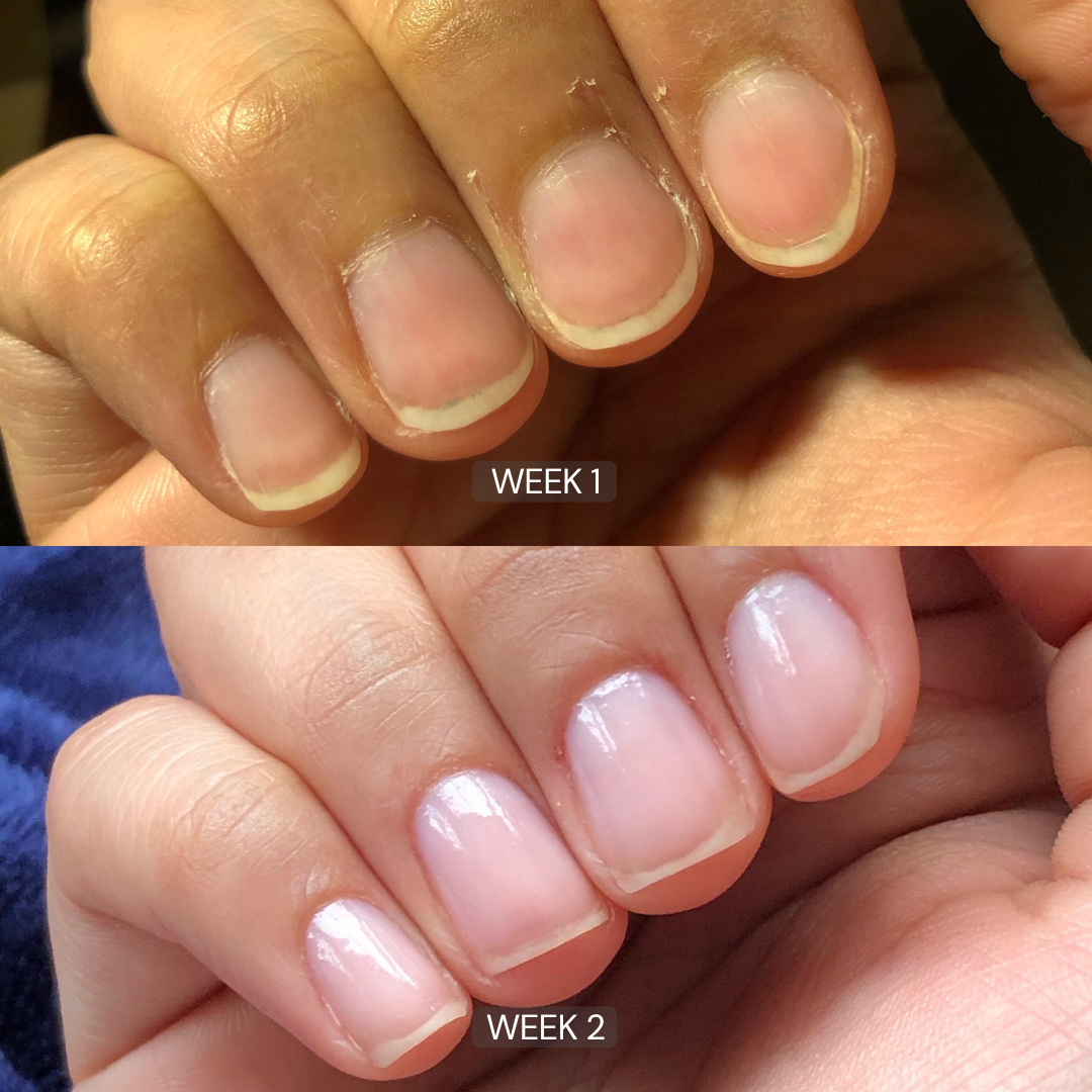 Nail Growth Oil