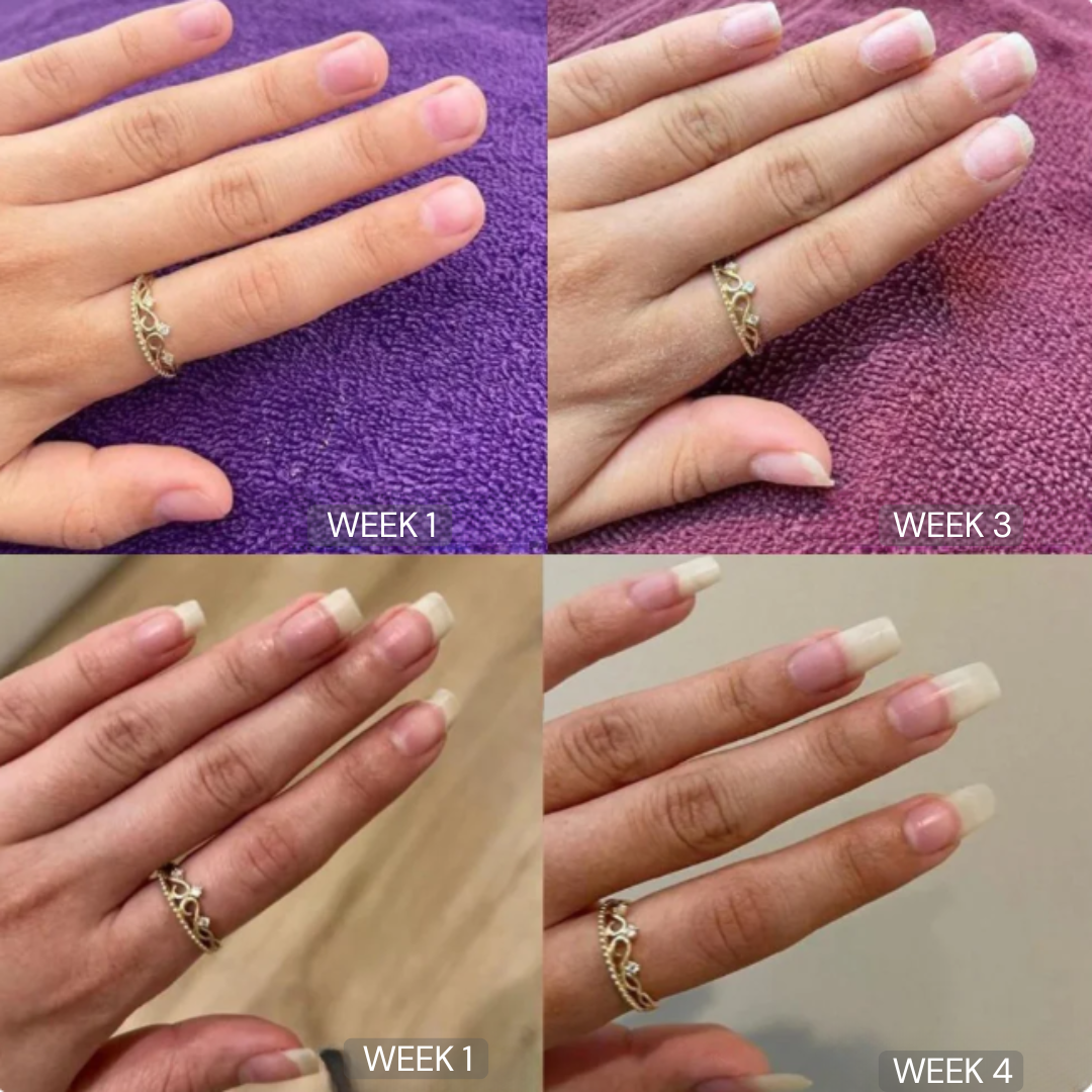 Nail Growth Oil