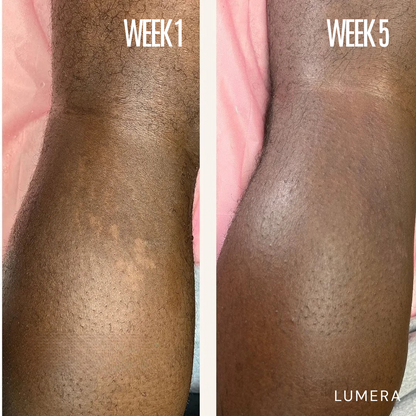 Lymphatic Drainage & Anti-Cellulite Massager